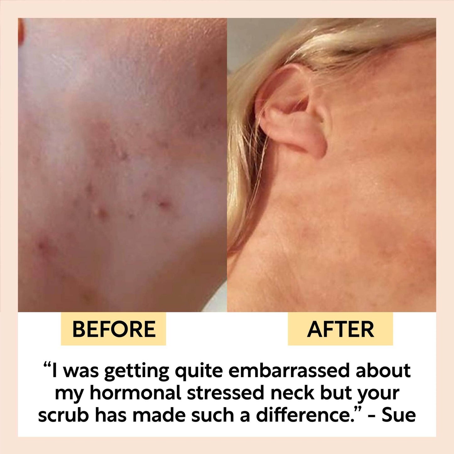 Coffee Face Scrub med Rosehip Oil – Reisestørrelse (30ml)