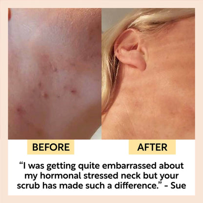 Coffee Face Scrub med Rosehip Oil – Reisestørrelse (30ml)