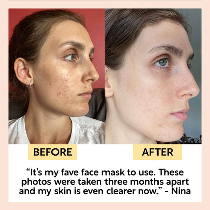 Face Mask med Kaolin Clay & Olive Stone Powder