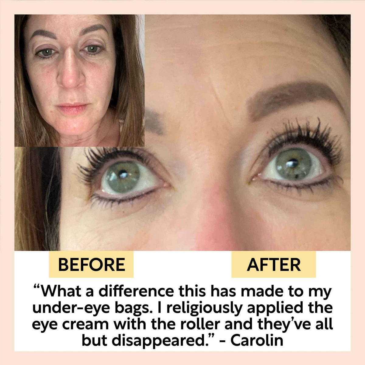 Eye Cream med Hyaluronic Acid & Coffee Oil