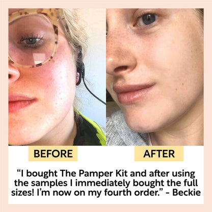 The Pamper Kit – Prøvepakke fra UpCircle
